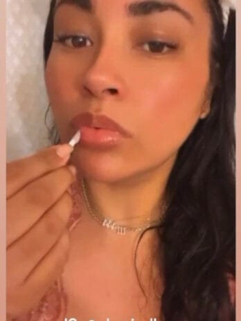 Akenis Lip Renewal Kit